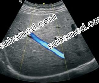 GE C1-5-D C1-5-RS Ultrasund Probe Head Scanner Crystal